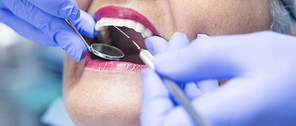 Best Emergency Treatment for Toothache in Russellville, AL